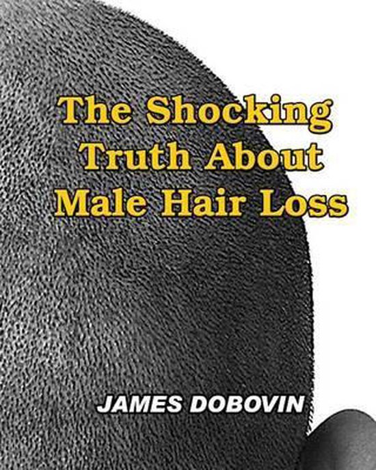 The Shocking Truth About Male Hair Loss - cover