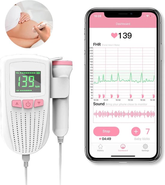 Moniteur cardiaque sans fil Smart UltraMed Babytone - Moniteur Doppler fœtal  portable... | bol.com