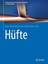 Meistertechniken in der operativen Orthopädie und Unfallchirurgie - Hüfte