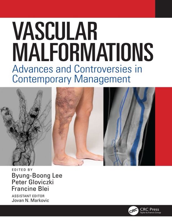 Vascular Malformations - cover