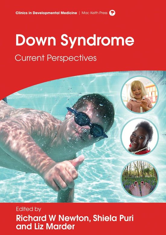 Down Syndrome: Current Perspectives - cover