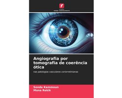 Angiografia por tomografia de coerência ótica