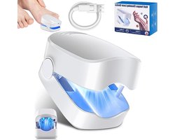 Anti Schimmel Laser Apparaat - Nagelschimmel Behandeling voor teennagel Snelwerkend 7 minuten thuisbehandeling voor handteennagelinfecties (1Pcs)