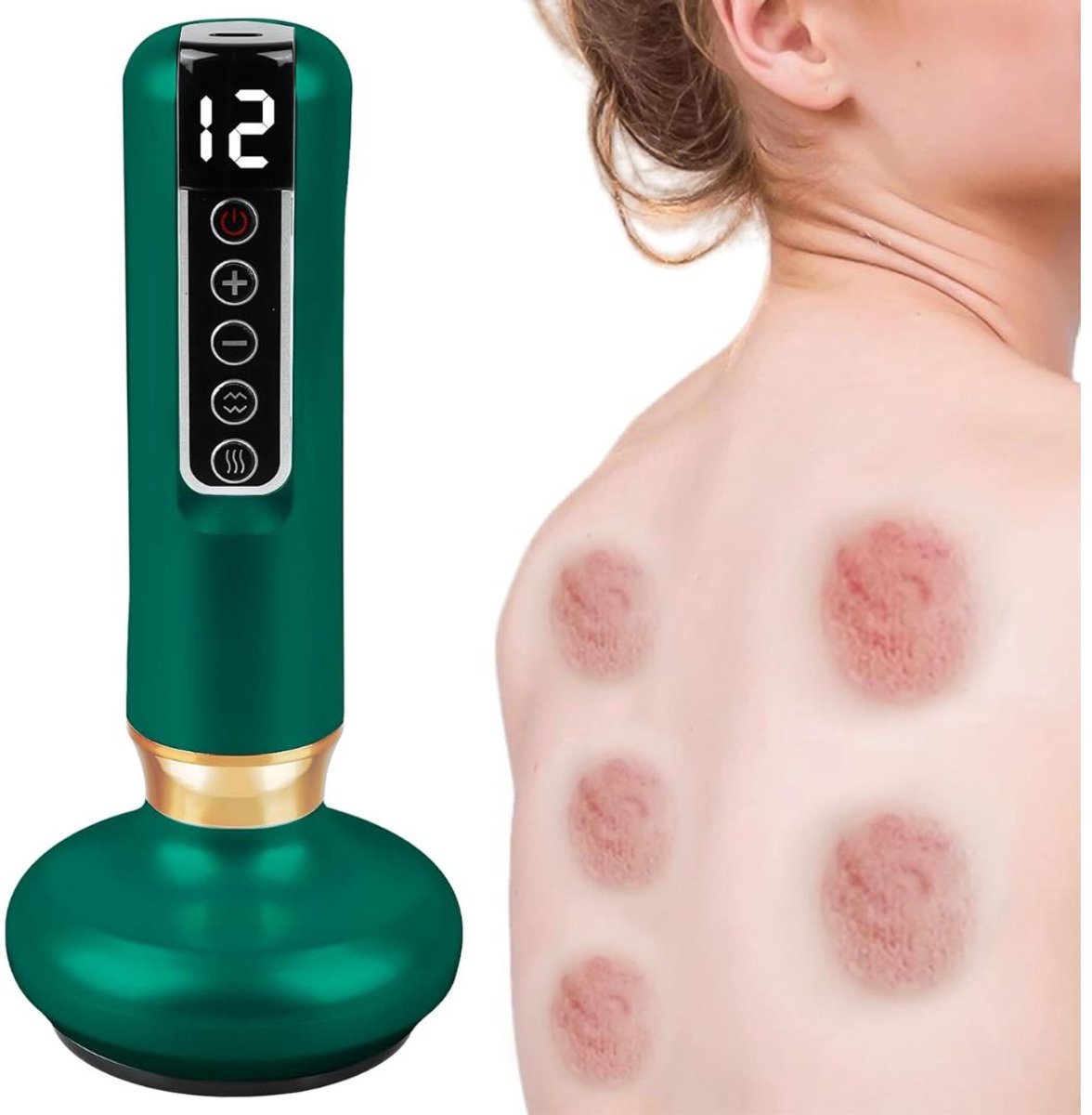 Cellulite Massage Apparaat - Massage Apparaat - Anti Cellulitis Apparaat - Cupping Cups - Groen