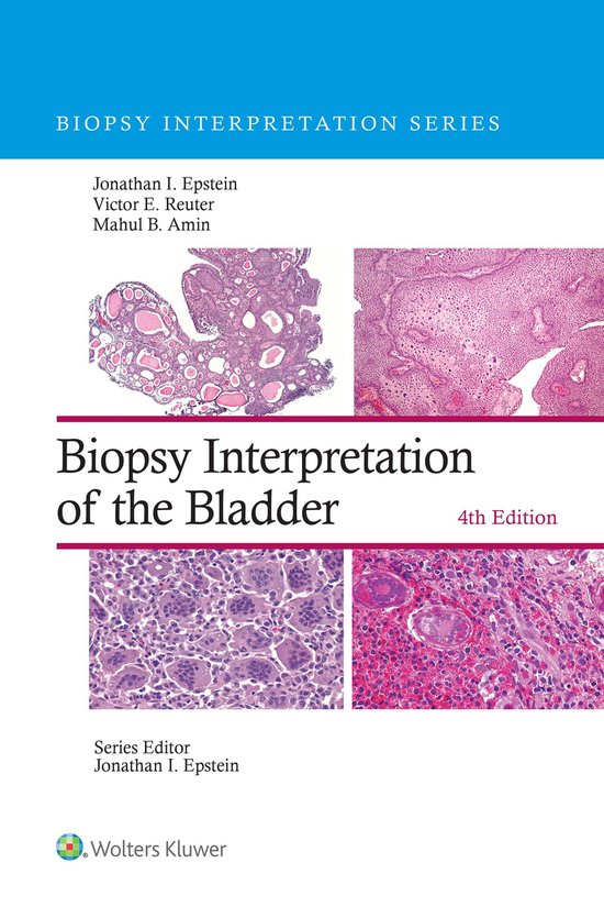 Biopsy Interpretation Series - Biopsy Interpretation of the Bladder