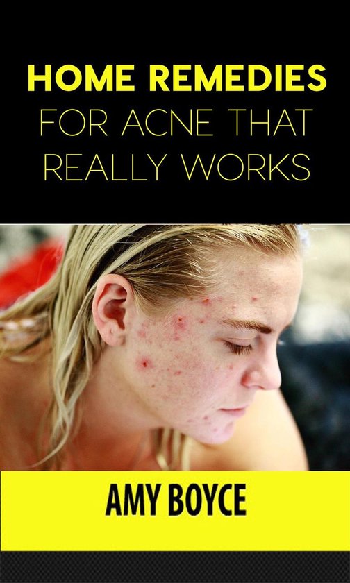 Home Remedies for Acne That Really Works - cover