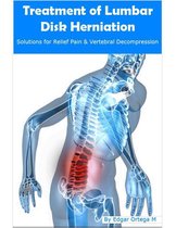 Treatment of Lumbar Disk Herniation