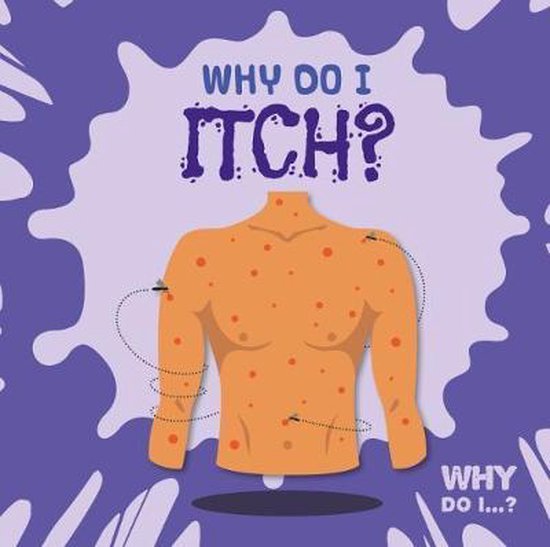 Why Do I Itch? 9781786373649 Kirsty Holmes Boeken