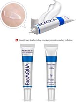 Bioaqua Pure Skin Acne Rejuvenation cream - Anti Acne - Gezichtsverzorging - 30ml