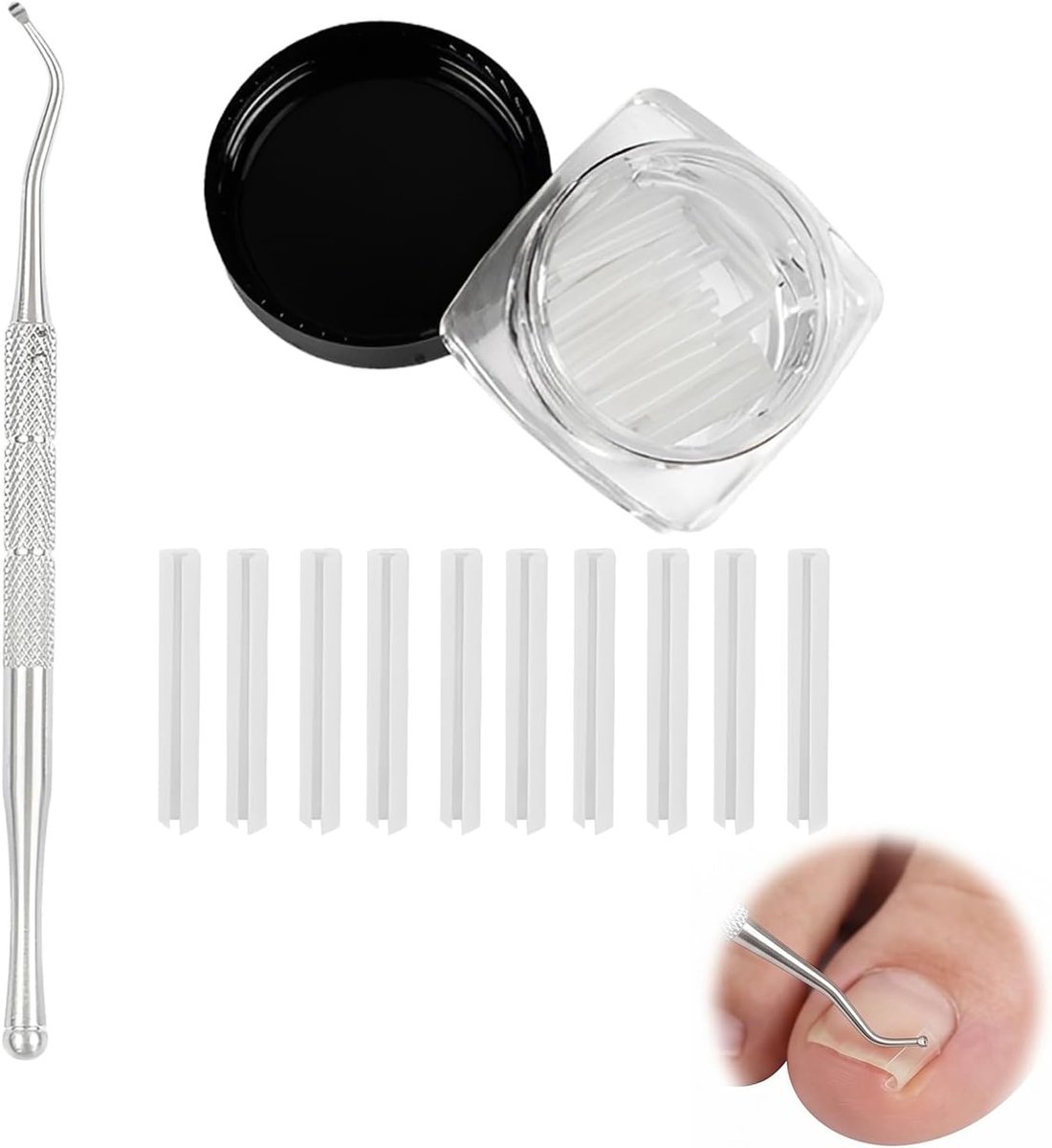 Correctieset ingegroeide teennagels - 50 pijnloze gladmakende strips - nagellifter van staal - ShopVlot