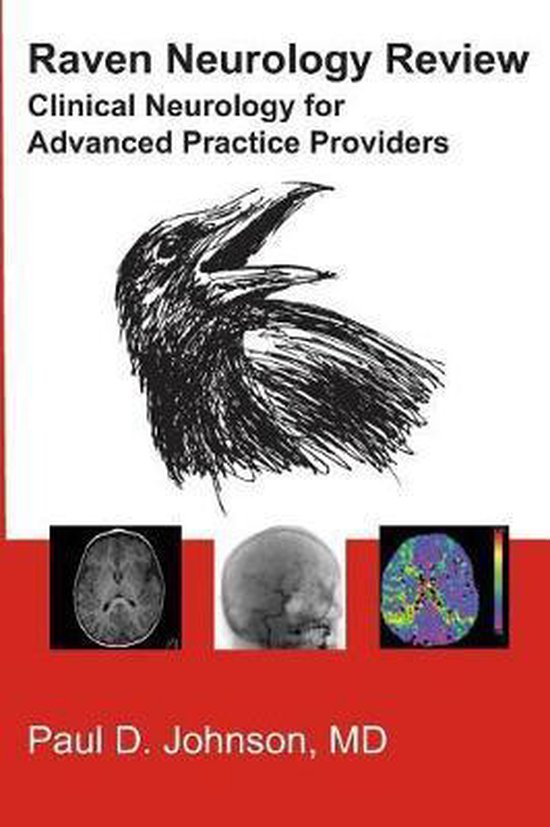 Raven Neurology Review 9781976212277 Paul Johnson Md Boeken bol