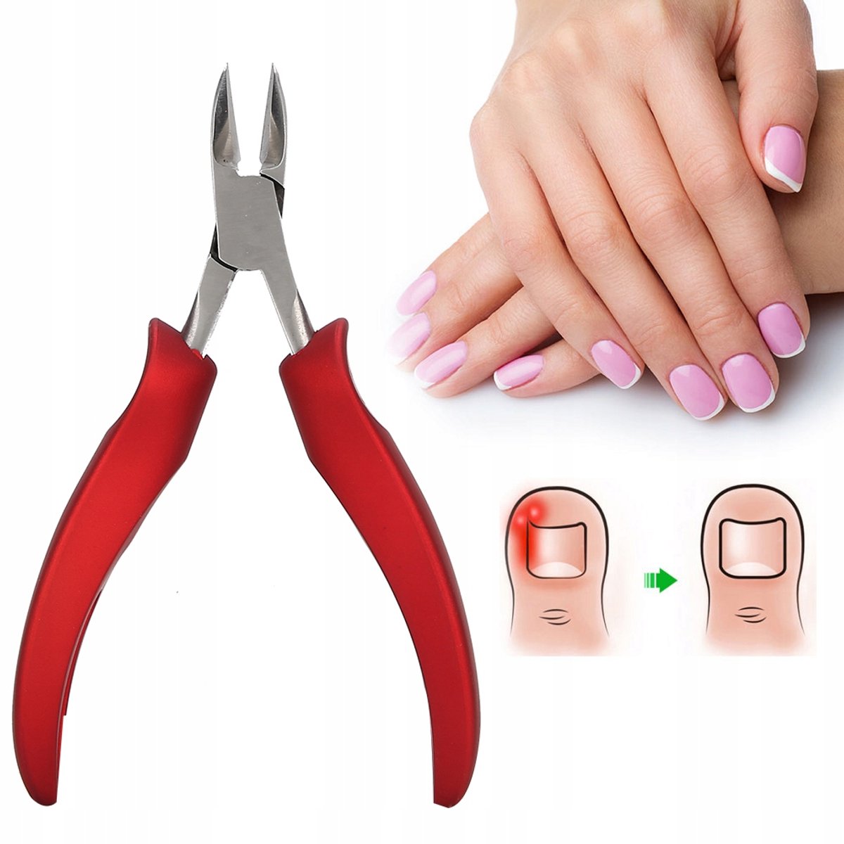 Nagelriemknipper voor ingegroeide teennagels - Roestvrij Staal