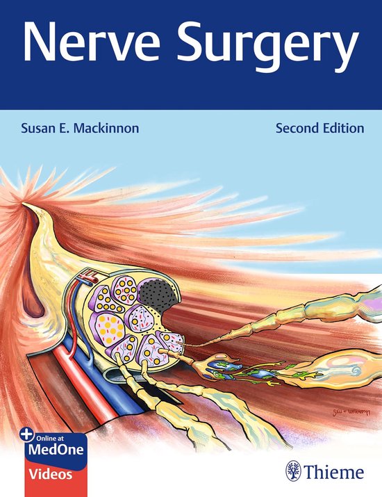 Nerve Surgery - cover