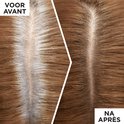 Voor en na foto van haarwortels, de linker kant toont witte uitgroei, de rechter kant toont gemodelleerde uitgroei.