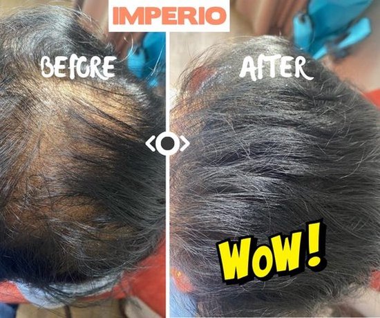 Vergelijking van haar voor en na IMPERIO haarvezels. Het haar is voller en dikker na gebruik. Met 'WOW!' tekst.