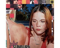 Sunburn