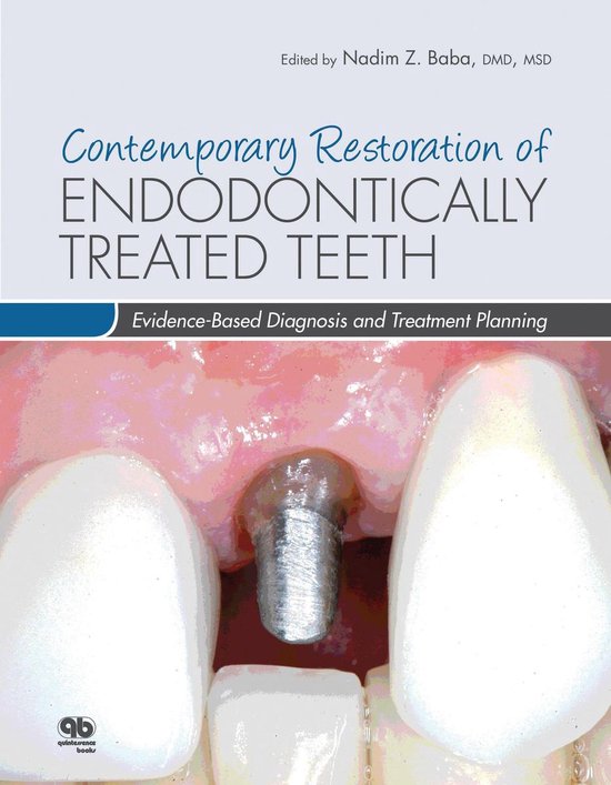 Contemporary Restoration of Endodontically Treated Teeth - cover