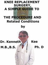 Knee Replacement Surgery, A Simple Guide To The Procedure And Related Conditions