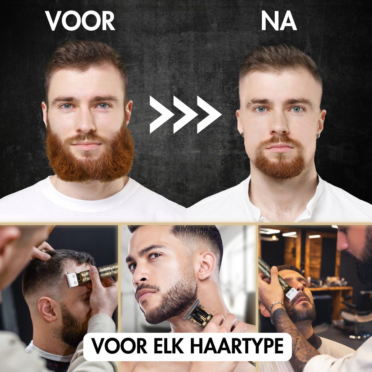 Professionele T-Blade Tondeuse thumbnail 2