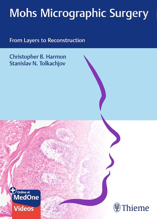 Mohs Micrographic Surgery: From Layers to Reconstruction - cover