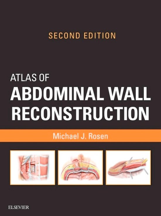 Atlas of Abdominal Wall Reconstruction E-Book - cover
