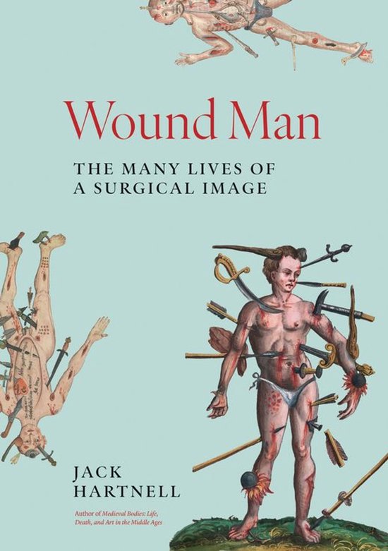 Wound Man - cover