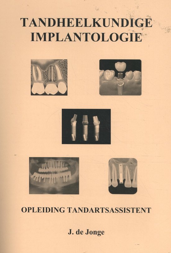 Tandheelkundige Implantologie - cover