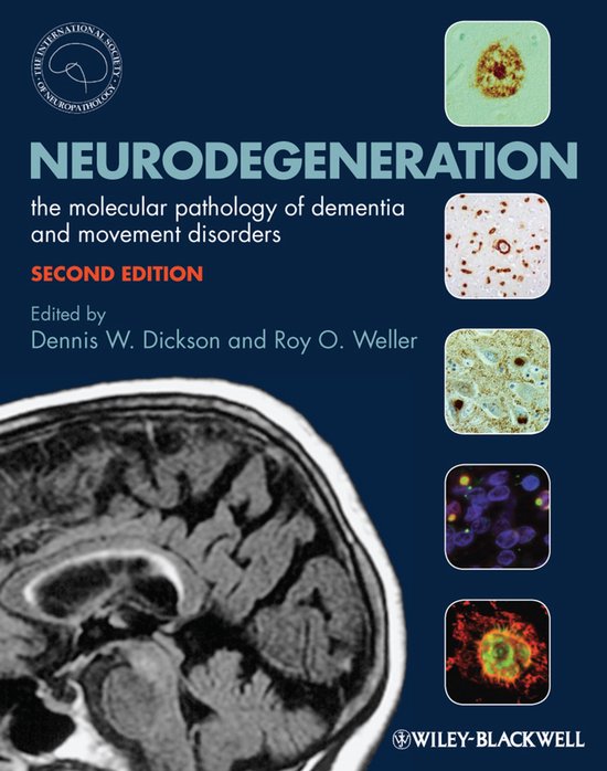 Neurodegeneration - cover