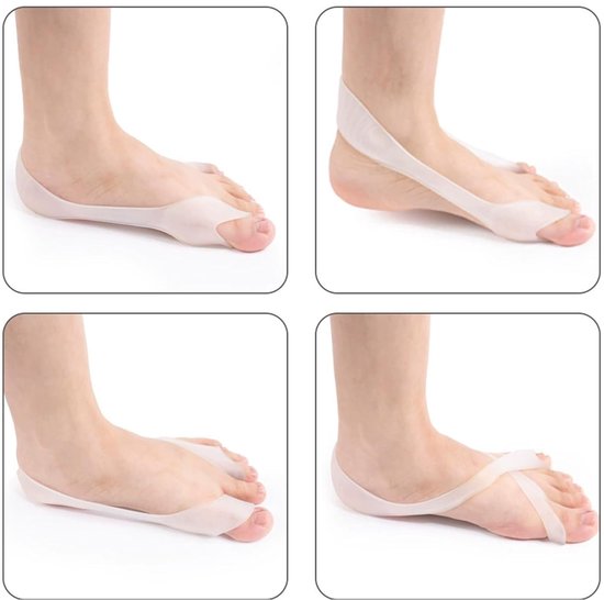 Corrector Set voor Hallux Valgus, Transparante Teenspanners en Grote Splints van Zacht Siliconen en Ademend Materiaal voor Comfort en Ondersteuning — afbeelding 4