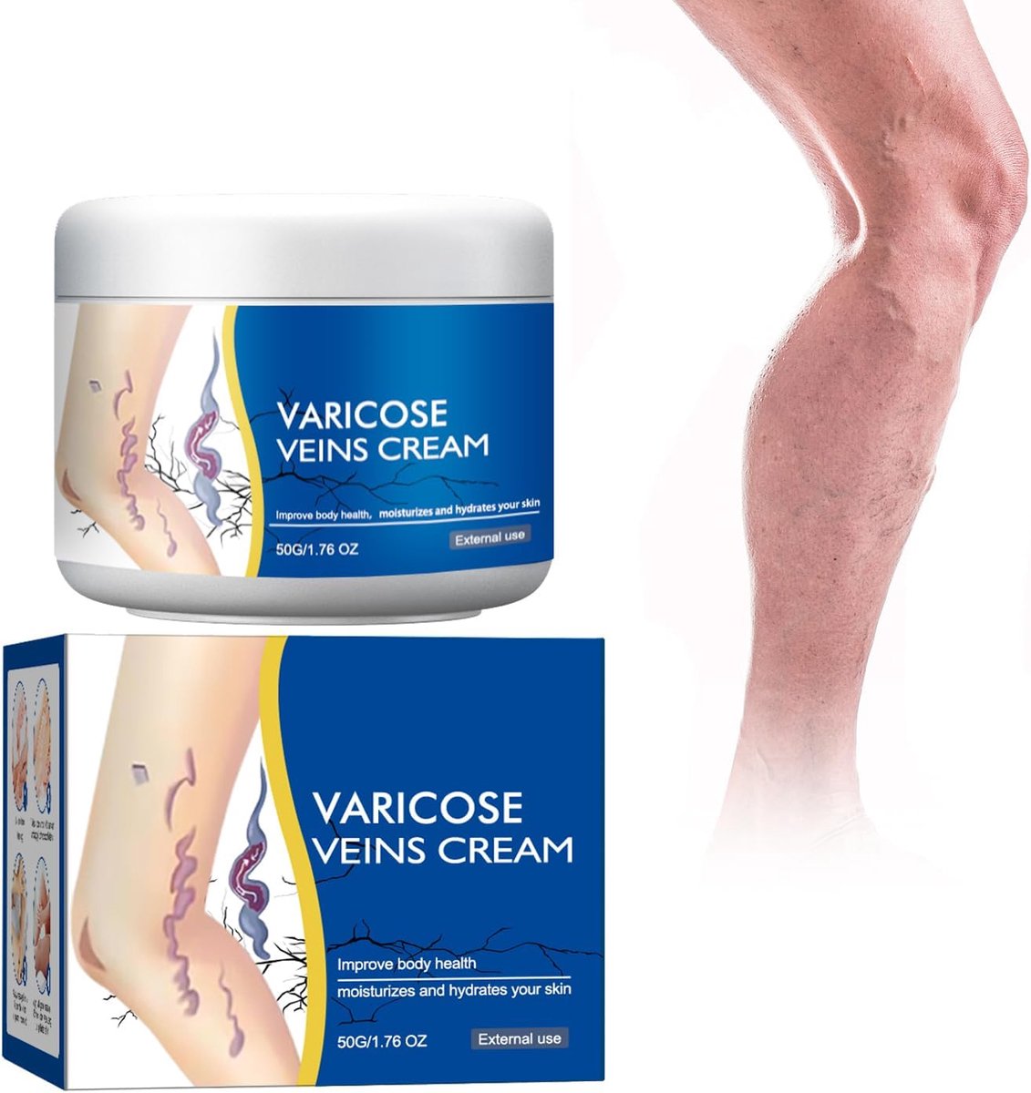 Spatadercrème, beenverzorgingsbalsem - crème tegen spinaderen, spataderen en spinaderen, natuurlijke beenverzorging - ShopVlot