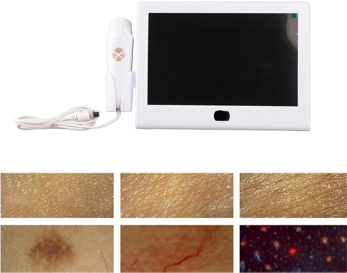 Oplaadbaar haarfollikelanalyseapparaat met geavanceerde hoofdhuiddetector, 3 lichtstanden en 50x/200x vergroting voor een optimale haardiagnose en gezonde haargroei.