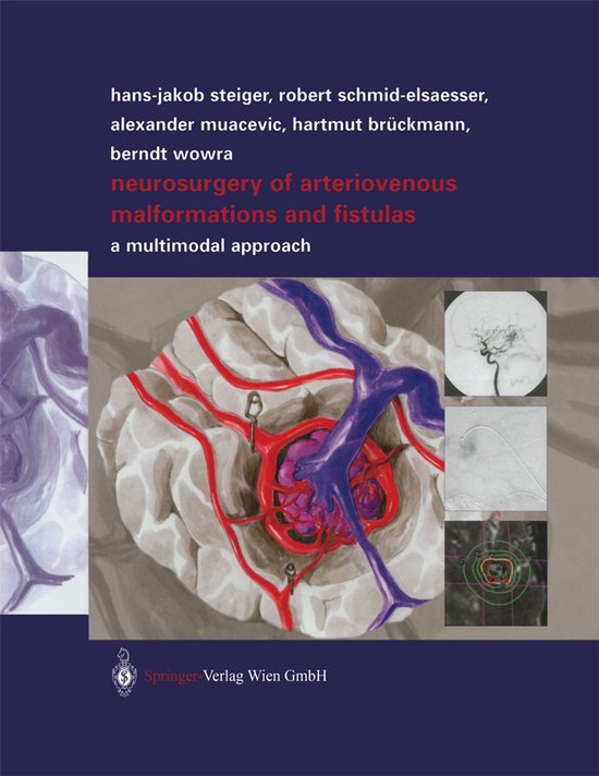 Neurosurgery of Arteriovenous Malformations and Fistulas - cover