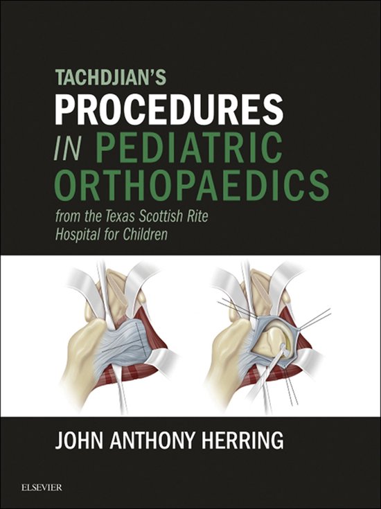 Tachdjian's Procedures in Pediatric Orthopaedics - cover