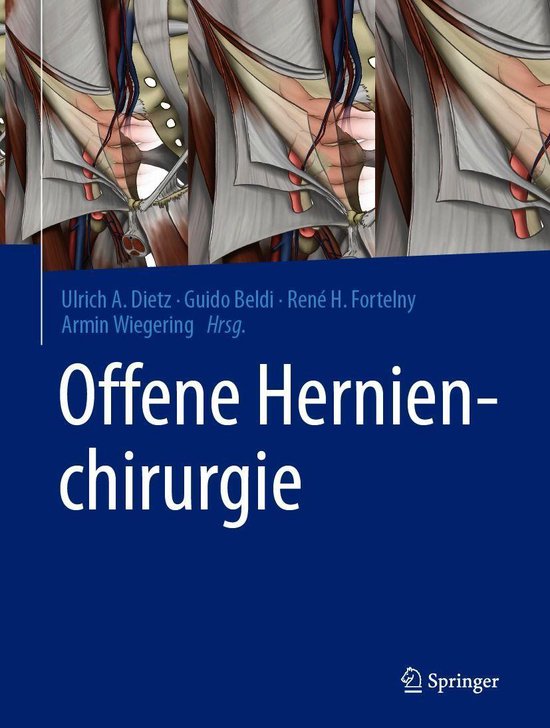 Medicine (German Language) - Offene Hernienchirurgie - cover
