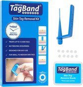 Tagband Skin Tag remover - Wrattenverwijderaar